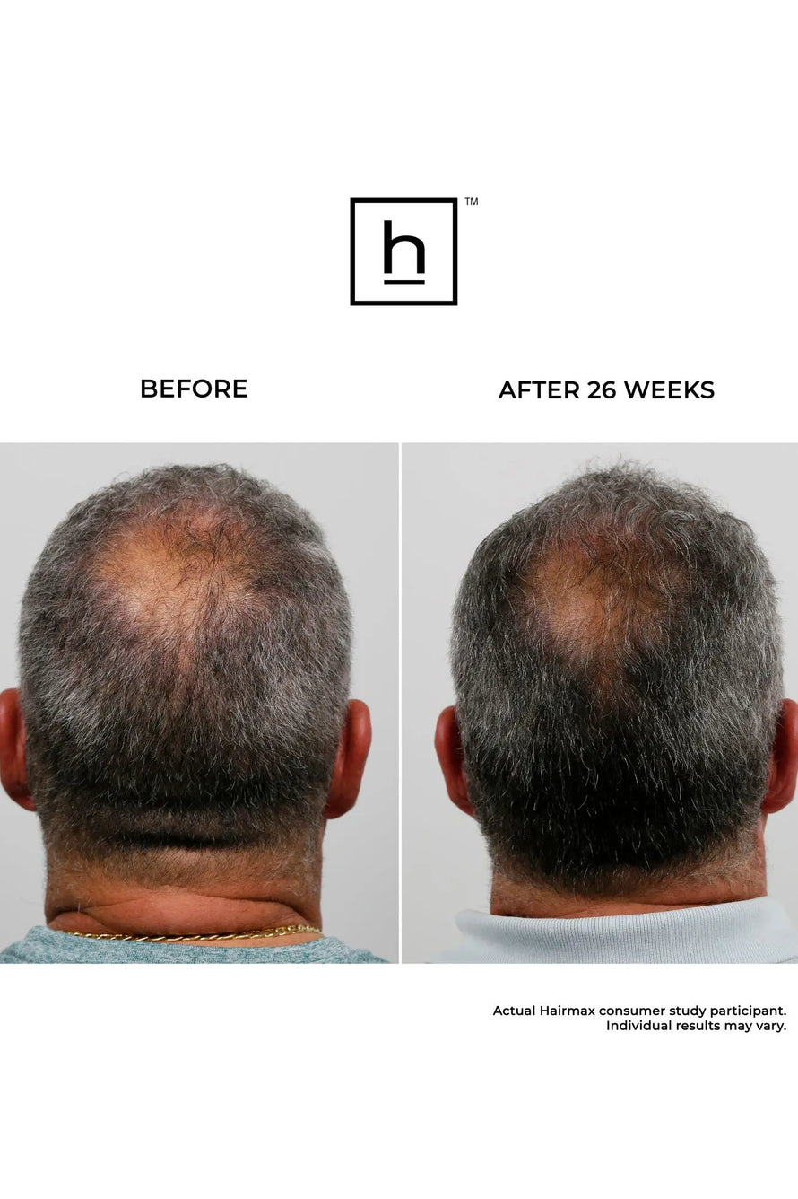 ULTIMA 9 LASERCOMB hairmax.co.uk