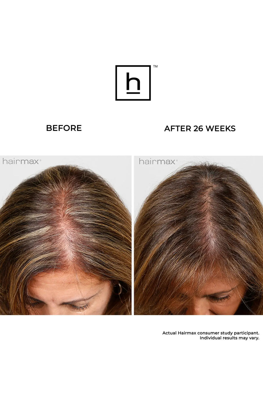 ULTIMA 9 LASERCOMB hairmax.co.uk